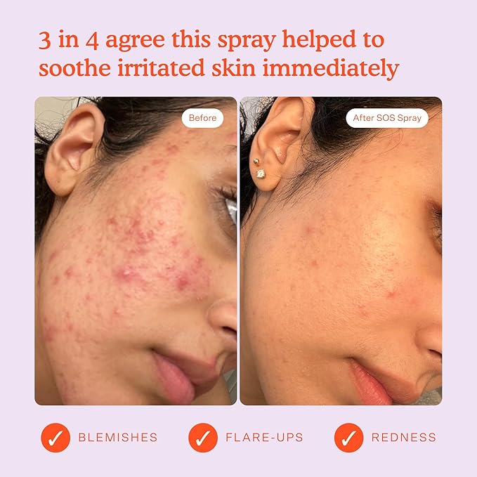 Tower 28 SOS Daily Rescue Facial Spray for Sensitive Skin (1 FL Oz)